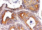 CD49a (Integrin alpha 1) Antibody in Immunohistochemistry (Paraffin) (IHC (P))