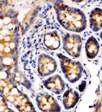 CD49a (Integrin alpha 1) Antibody in Immunohistochemistry (Paraffin) (IHC (P))