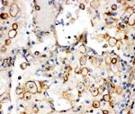 CD49a (Integrin alpha 1) Antibody in Immunohistochemistry (Paraffin) (IHC (P))