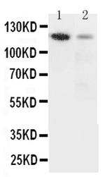 CD49c (Integrin alpha 3) Antibody in Western Blot (WB)