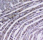 CD49e (Integrin alpha 5) Antibody in Immunohistochemistry (Paraffin) (IHC (P))