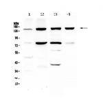 CD49e (Integrin alpha 5) Antibody in Western Blot (WB)