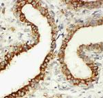 CD61 (Integrin beta 3) Antibody in Immunohistochemistry (Paraffin) (IHC (P))