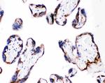 CD104 (Integrin beta 4) Antibody in Immunohistochemistry (Paraffin) (IHC (P))