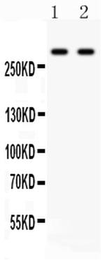 ITPR3 Antibody in Western Blot (WB)