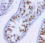 MCAK Antibody in Immunohistochemistry (Paraffin) (IHC (P))