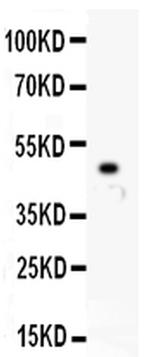 MCAK Antibody in Western Blot (WB)