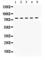 KIF3A Antibody in Western Blot (WB)