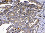 SCF Antibody in Immunohistochemistry (Paraffin) (IHC (P))