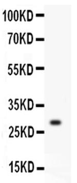 Kallikrein 1 Antibody in Western Blot (WB)