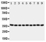 Kallikrein 10 Antibody in Western Blot (WB)