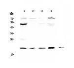 Kallikrein 2 Antibody in Western Blot (WB)