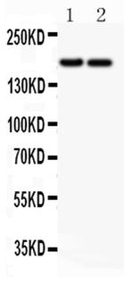 Laminin gamma-1,2,3 Antibody in Western Blot (WB)