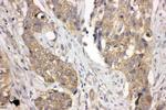 LASP1 Antibody in Immunohistochemistry (Paraffin) (IHC (P))