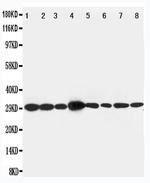 LASP1 Antibody in Western Blot (WB)