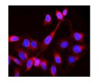 LCK Antibody in Immunocytochemistry (ICC/IF)