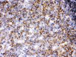 LCK Antibody in Immunohistochemistry (Paraffin) (IHC (P))