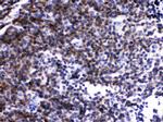 LCK Antibody in Immunohistochemistry (Paraffin) (IHC (P))