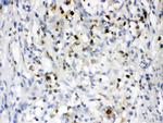 NGAL Antibody in Immunohistochemistry (Paraffin) (IHC (P))