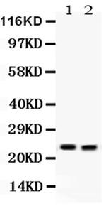 NGAL Antibody in Western Blot (WB)