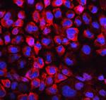 LDHB Antibody in Immunocytochemistry (ICC/IF)