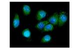 Galectin 3 Antibody in Immunocytochemistry (ICC/IF)