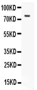 LHR Antibody in Western Blot (WB)