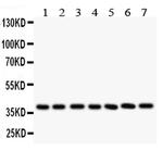 LIF Antibody in Western Blot (WB)