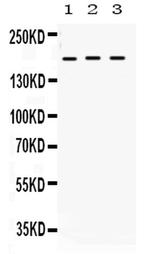 LIFR Antibody in Western Blot (WB)