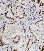 Lamin A/C Antibody in Immunohistochemistry (Paraffin) (IHC (P))