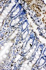 Lamin B2 Antibody in Immunohistochemistry (Paraffin) (IHC (P))