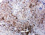 LTBR Antibody in Immunohistochemistry (Paraffin) (IHC (P))