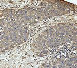 MEK3 Antibody in Immunohistochemistry (Paraffin) (IHC (P))