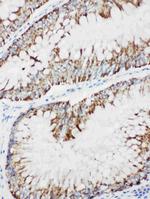 MEKK1 Antibody in Immunohistochemistry (Paraffin) (IHC (P))