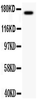 MEKK1 Antibody in Western Blot (WB)