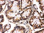 JNK1/JNK2 Antibody in Immunohistochemistry (Paraffin) (IHC (P))