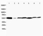 JNK1/JNK2 Antibody in Western Blot (WB)