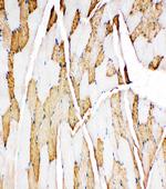 Myoglobin Antibody in Immunohistochemistry (Paraffin) (IHC (P))