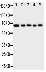 MBD4 Antibody in Western Blot (WB)