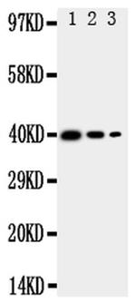 MBD4 Antibody in Western Blot (WB)