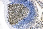 MCM2 Antibody in Immunohistochemistry (Paraffin) (IHC (P))