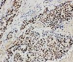 MCM3 Antibody in Immunohistochemistry (Paraffin) (IHC (P))