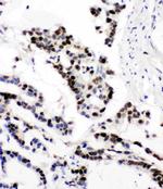 MCM6 Antibody in Immunohistochemistry (Paraffin) (IHC (P))