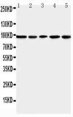 MCM6 Antibody in Western Blot (WB)