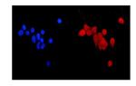 MGMT Antibody in Immunocytochemistry (ICC/IF)