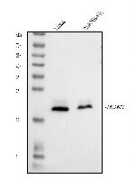 MGMT Antibody in Western Blot (WB)