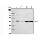 MICA Antibody in Western Blot (WB)