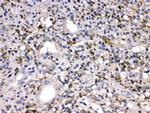 MMP11 Antibody in Immunohistochemistry (Paraffin) (IHC (P))