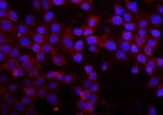 MMP16 Antibody in Immunocytochemistry (ICC/IF)