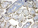 MMP16 Antibody in Immunohistochemistry (Paraffin) (IHC (P))